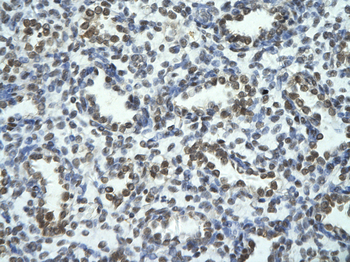 TRIOBP Rabbit Polyclonal Antibody