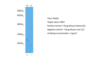 CBX3 Rabbit Polyclonal Antibody