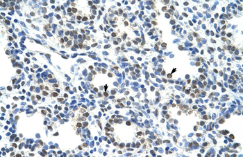 CBX3 Rabbit Polyclonal Antibody