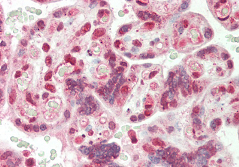 CBX3 Rabbit Polyclonal Antibody