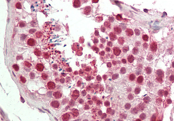 CBX3 Rabbit Polyclonal Antibody