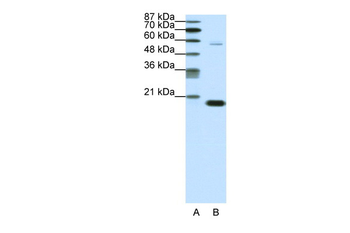 CBX3 Rabbit Polyclonal Antibody