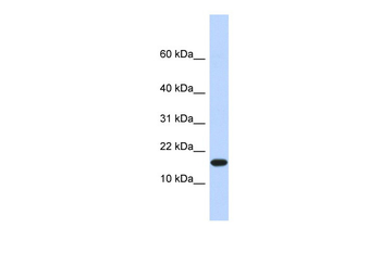 EGLN2 Rabbit Polyclonal Antibody