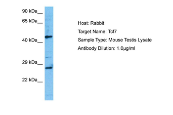 TCF7 Rabbit Polyclonal Antibody