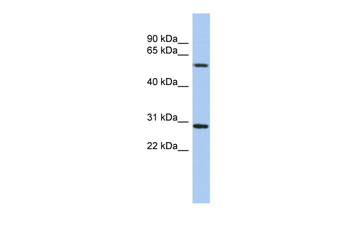 TRIM38 Rabbit Polyclonal Antibody