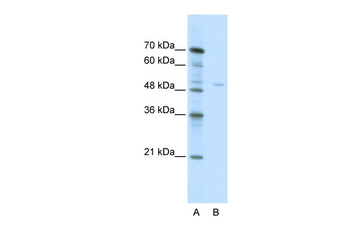 TRIM38 Rabbit Polyclonal Antibody