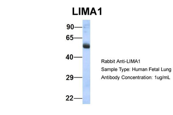 LIMA1 Rabbit Polyclonal Antibody