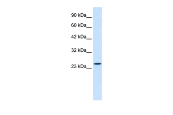 ZNF22 Rabbit Polyclonal Antibody