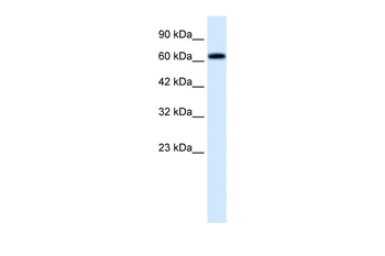 TRIM9 Rabbit Polyclonal Antibody