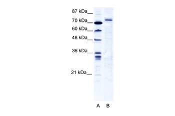 TRIM9 Rabbit Polyclonal Antibody