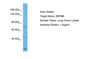 ZMYM6 Rabbit Polyclonal Antibody