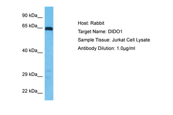 DIDO1 Rabbit Polyclonal Antibody