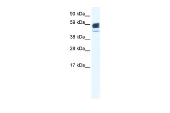 CHRNA1 Rabbit Polyclonal Antibody