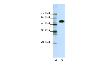 CLCNKB Rabbit Polyclonal Antibody