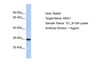 ASIC1 Rabbit Polyclonal Antibody