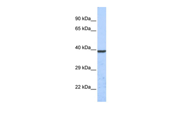 KCNK1 Rabbit Polyclonal Antibody