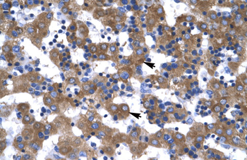 VDAC1 Rabbit Polyclonal Antibody