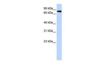 KCNC3 Rabbit Polyclonal Antibody