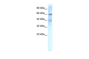 KCND3 Rabbit Polyclonal Antibody