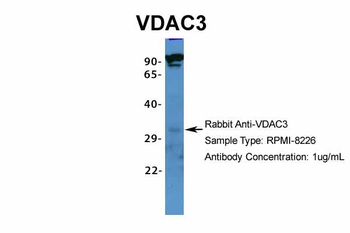 VDAC3 Rabbit Polyclonal Antibody