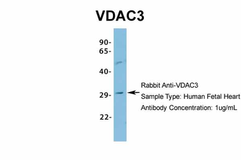 VDAC3 Rabbit Polyclonal Antibody
