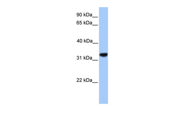 CACNG4 Rabbit Polyclonal Antibody