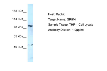 GRIK4 Rabbit Polyclonal Antibody