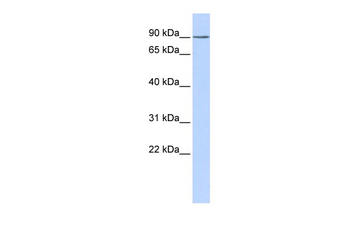 KCTD3 Rabbit Polyclonal Antibody