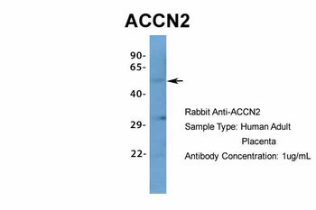 ACCN2 Rabbit Polyclonal Antibody