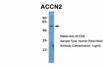 ACCN2 Rabbit Polyclonal Antibody