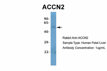 ACCN2 Rabbit Polyclonal Antibody