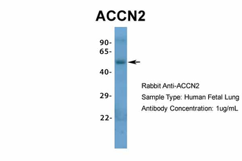 ACCN2 Rabbit Polyclonal Antibody
