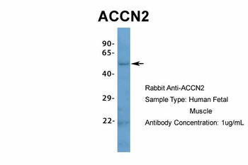 ACCN2 Rabbit Polyclonal Antibody