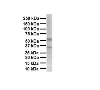 TRPV4 Rabbit Polyclonal Antibody
