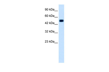 CLCN6 Rabbit Polyclonal Antibody