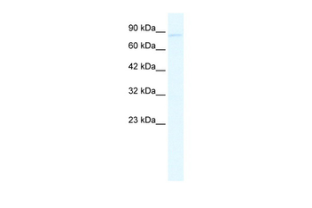 GRIK2 Rabbit Polyclonal Antibody