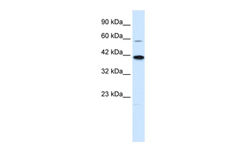 KCNK13 Rabbit Polyclonal Antibody