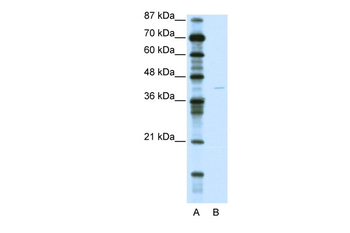 KCNA7 Rabbit Polyclonal Antibody