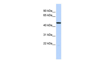 HTR3C Rabbit Polyclonal Antibody