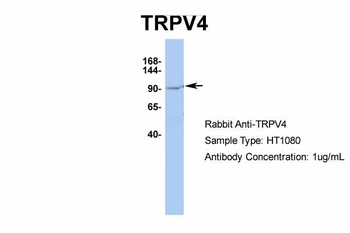 TRPV4 Rabbit Polyclonal Antibody