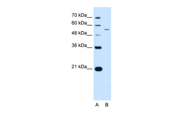 KCNQ2 Rabbit Polyclonal Antibody