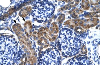 KCNQ2 Rabbit Polyclonal Antibody