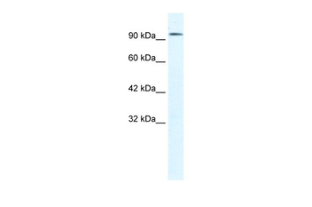 CLCN3 Rabbit Polyclonal Antibody