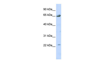 P2RX2 Rabbit Polyclonal Antibody