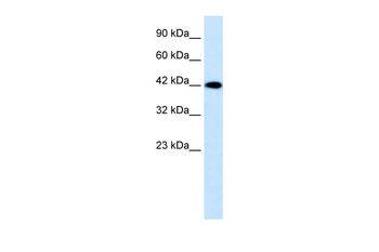 P2RX2 Rabbit Polyclonal Antibody