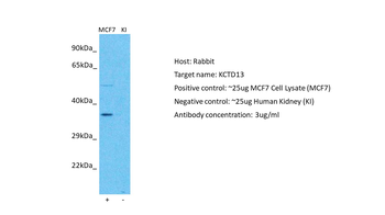 KCTD13 Rabbit Polyclonal Antibody