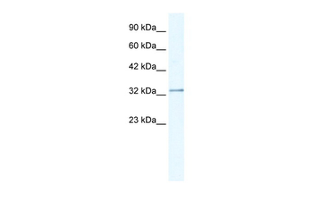 NUDT9 Rabbit Polyclonal Antibody