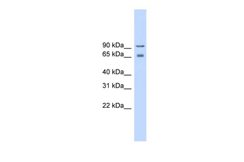 CACNB2 Rabbit Polyclonal Antibody