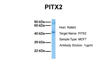 PITX2 Rabbit Polyclonal Antibody
