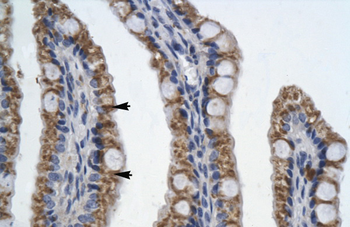 PITX2 Rabbit Polyclonal Antibody